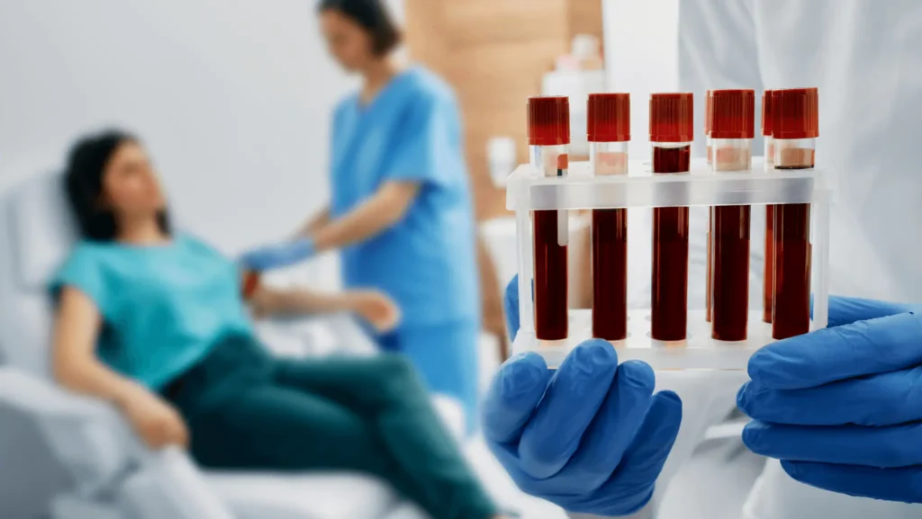GOT érték vizsgálata a Lotusz Medical Centerben Budapesten.