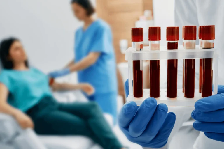 GOT érték vizsgálata a labordiagnosztikában. Vérvétel a Lotusz Medical Centerben Budapesten.