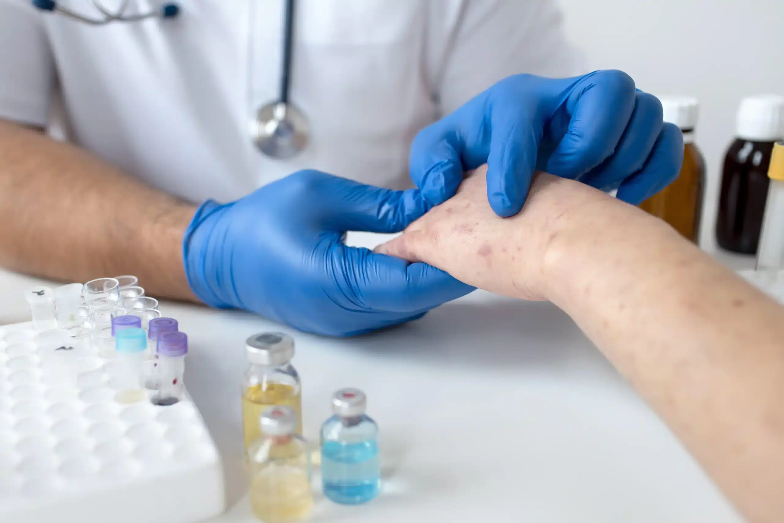Majomhimlő tüneteinek kezelése a Lotusz Medical Centerben Budapesten.