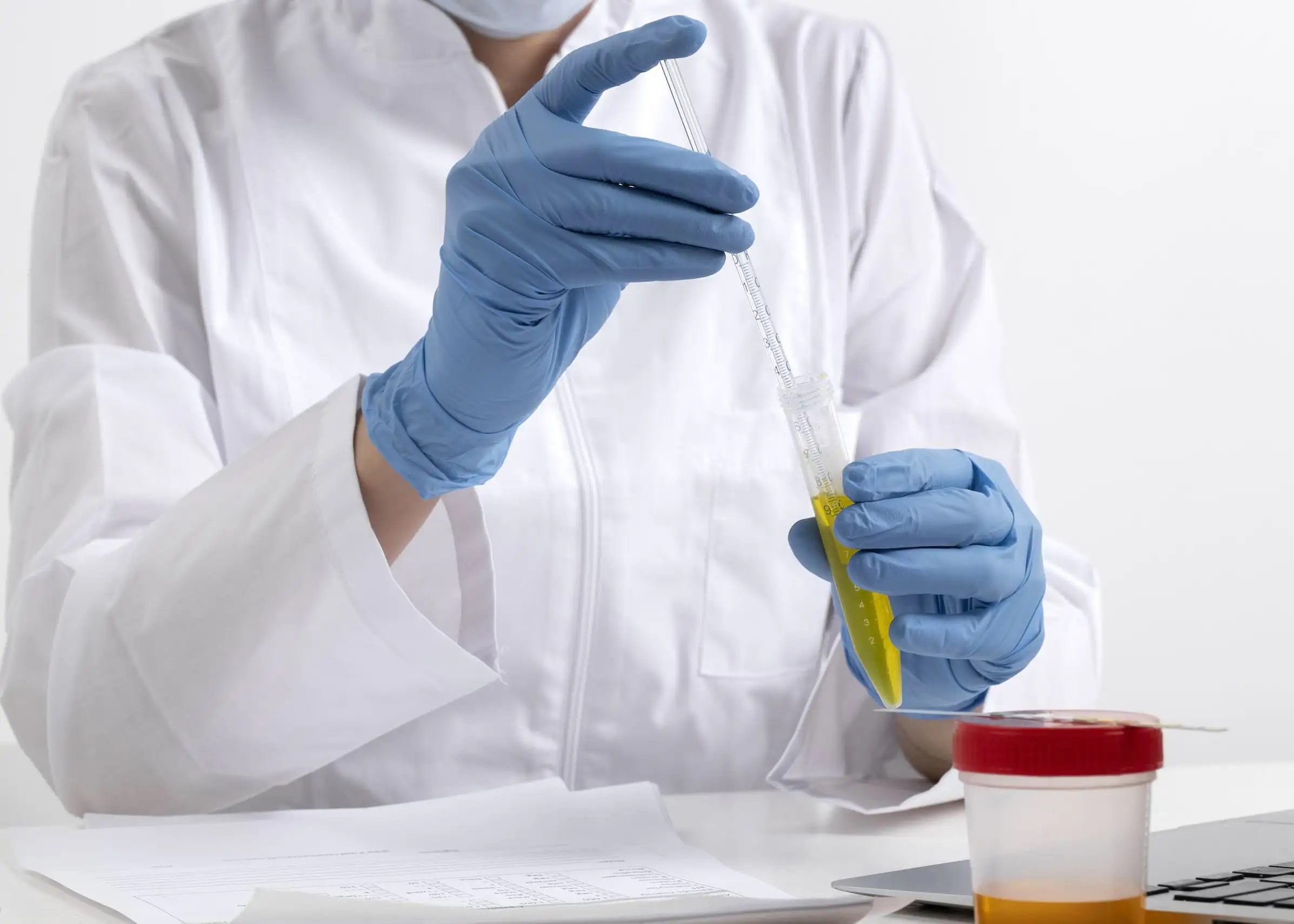 Vizelet mikroalbumin: a vesekárosodás korai indikátora.