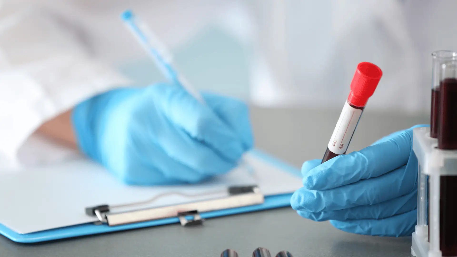 kreatinin-crea-cre-vesemukodes Kreatinin (Crea, Cre): a veseműködés legfontosabb értéke a vérképen
