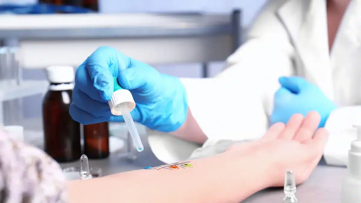 Allergiavizsgálat - Bőrteszt a Lotusz Medical Centerben